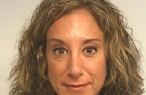 BOTOX® Before & After Gallery - Patient 202973 - Image 2