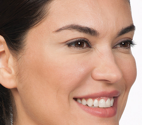 BOTOX® Before & After Gallery - Patient 597735 - Image 4