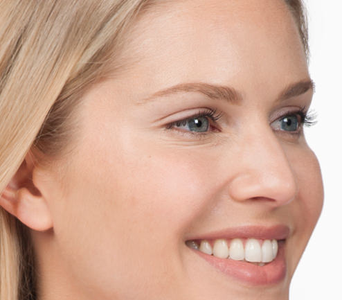 BOTOX® Before & After Gallery - Patient 387208 - Image 4