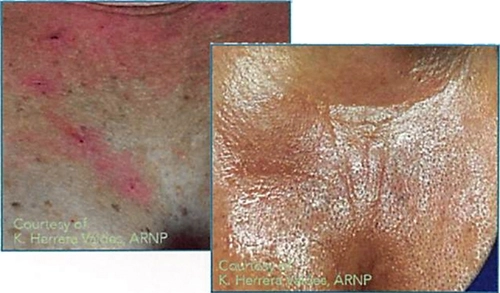 Medi Threads Results