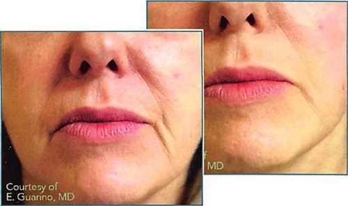 Medi Threads Results