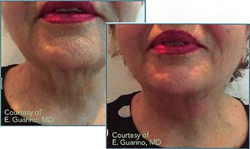 Medi Threads Results