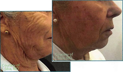 Medi Threads Results